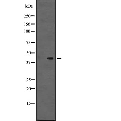 P2Y13 / P2RY13 Antibody