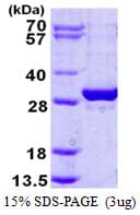 Human EXOSC5 Protein (Recombinant His)