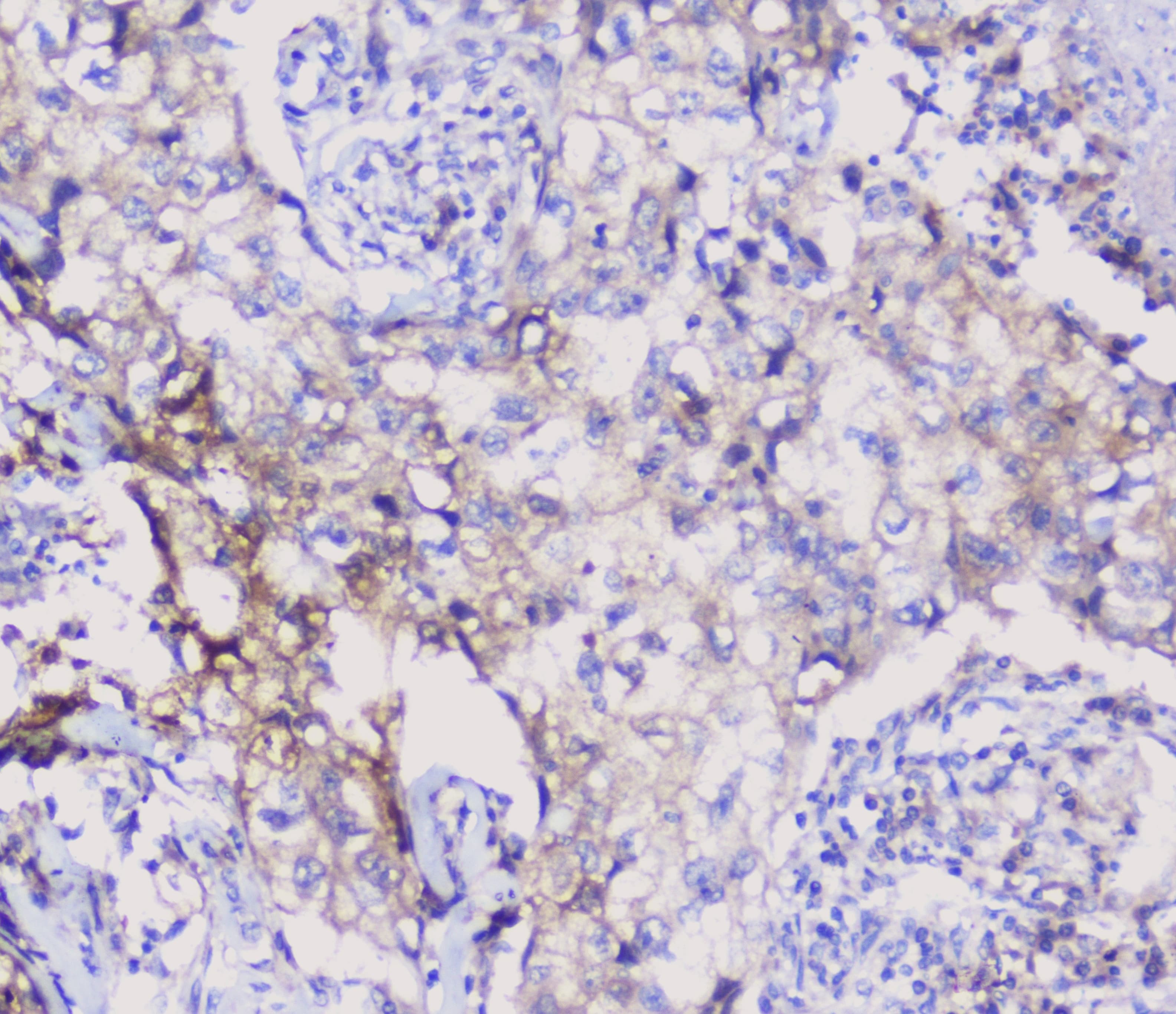 ENO2 / NSE Antibody