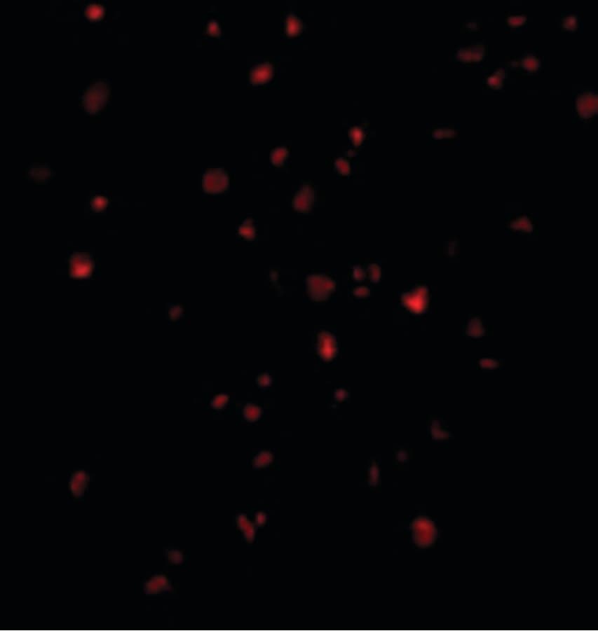 IHC-plus™ ERN1 / IRE1 Antibody