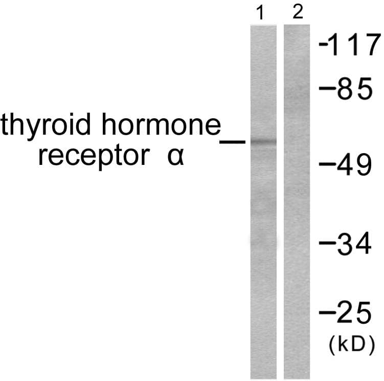 THRA / THR Alpha Antibody