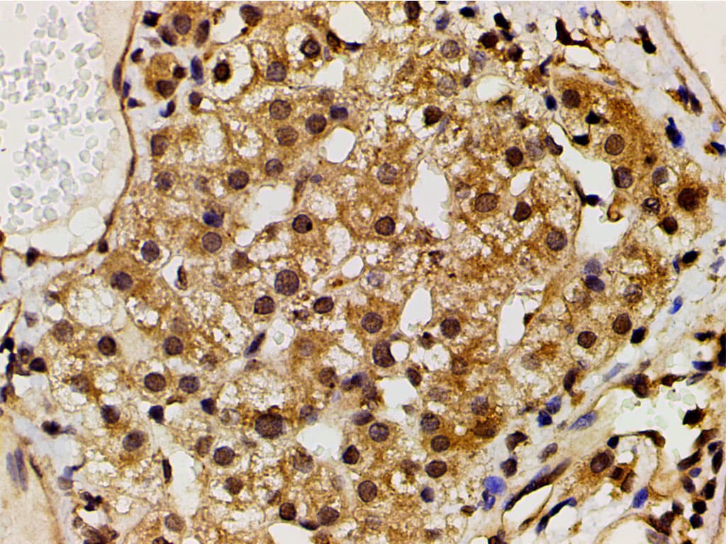 PIK3R1 / p85 Alpha Antibody (phospho-Tyr607)