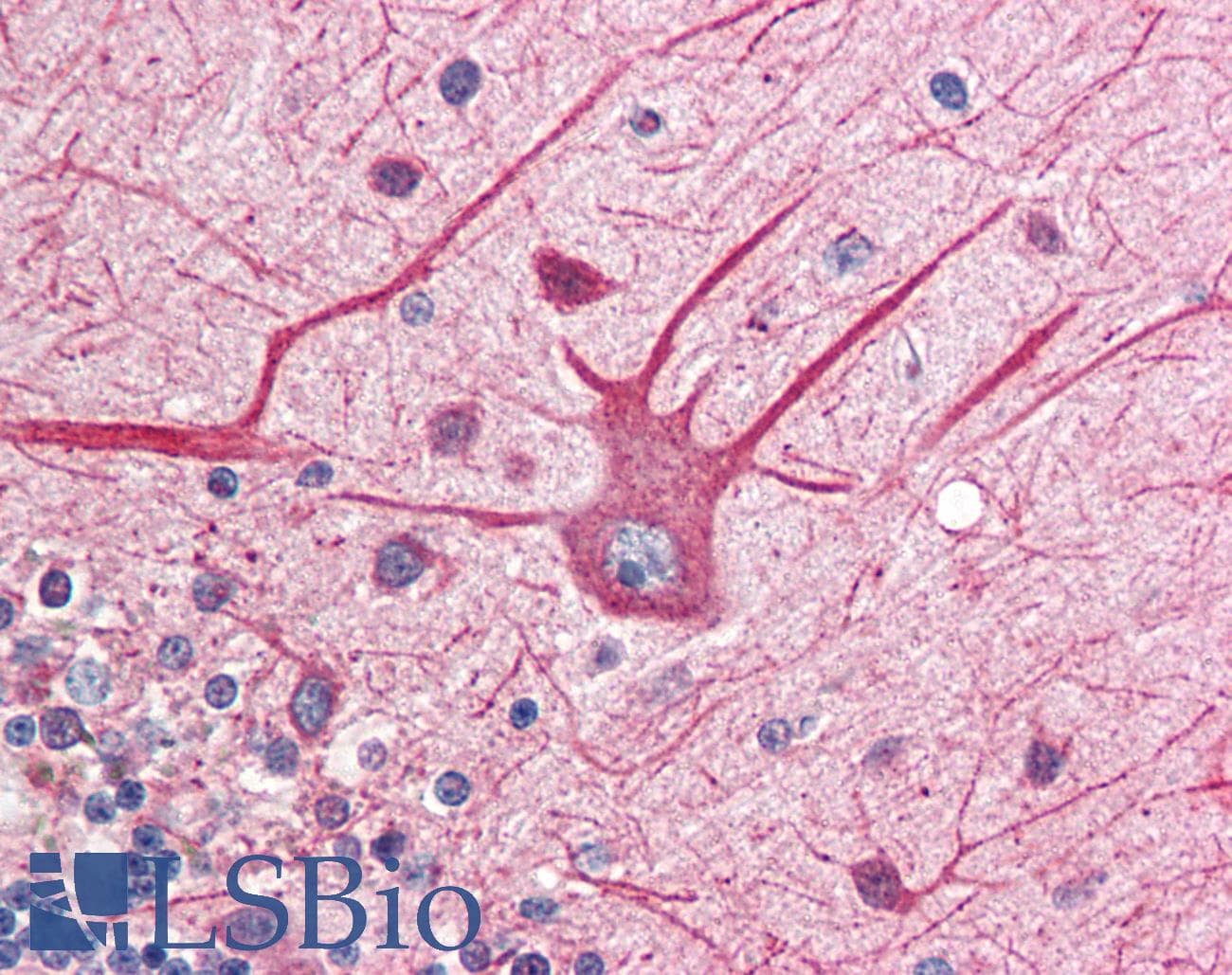 IHC-plus™ EIF2AK2 / PKR Antibody