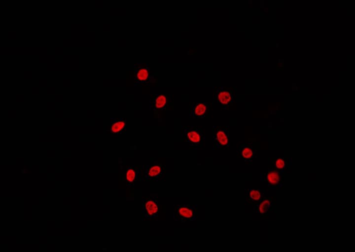 TBP / GTF2D Antibody