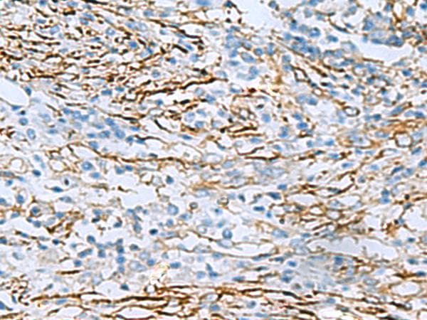 Polyclonal Rabbit anti-Human DPYSL3 / CRMP4 Antibody (IHC)