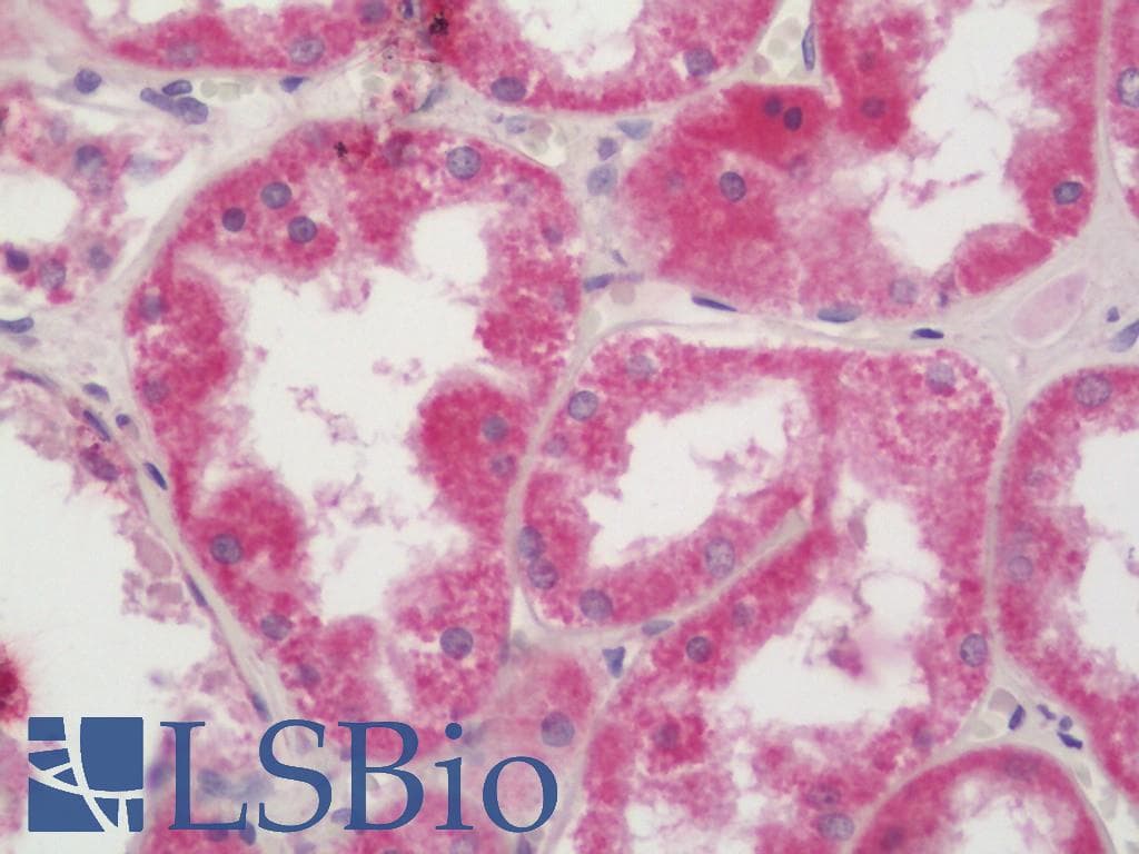 PHPT1 Antibody (HRP)