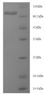 Mouse DSG3 / Desmoglein 3 Protein (Recombinant 6His-SUMO, N-terminus)