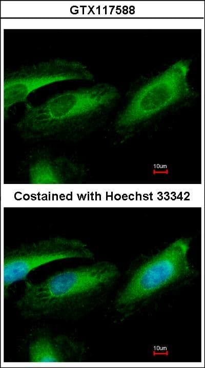 IHC-plus™ RCHY1 / PIRH2 Antibody