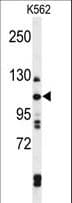 Polyclonal Rabbit anti-Human TELO2 Antibody (aa786-812, IHC, WB)