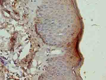 Polyclonal Rabbit anti-Human NR2C2AP / TRA16 Antibody (IHC, WB)