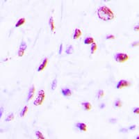 C/EBP Beta / CEBPB Antibody (phospho-Thr235)