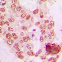 GRK5 Antibody (Internal)