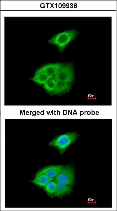 Polyclonal Rabbit anti-Human PNLIP / PL / Pancreatic Lipase Antibody (aa21-300, IHC, WB)