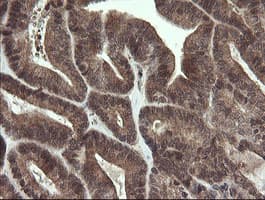 P3H1 / LEPRE1 Antibody (clone OTI1H3)