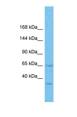 Polyclonal Rabbit anti-Human PAL / PAM Antibody (C-Terminus, WB)