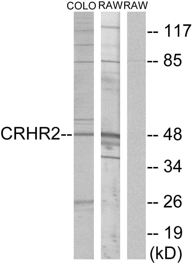 CRHR2 / CRF2 Receptor Antibody