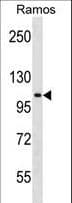 TACC1 Antibody (aa117-145)
