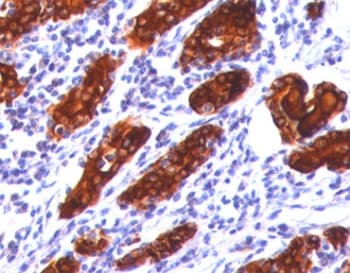 TG / Thyroglobulin Antibody (clone 2H11 or TGB04, Ready-to-Use)