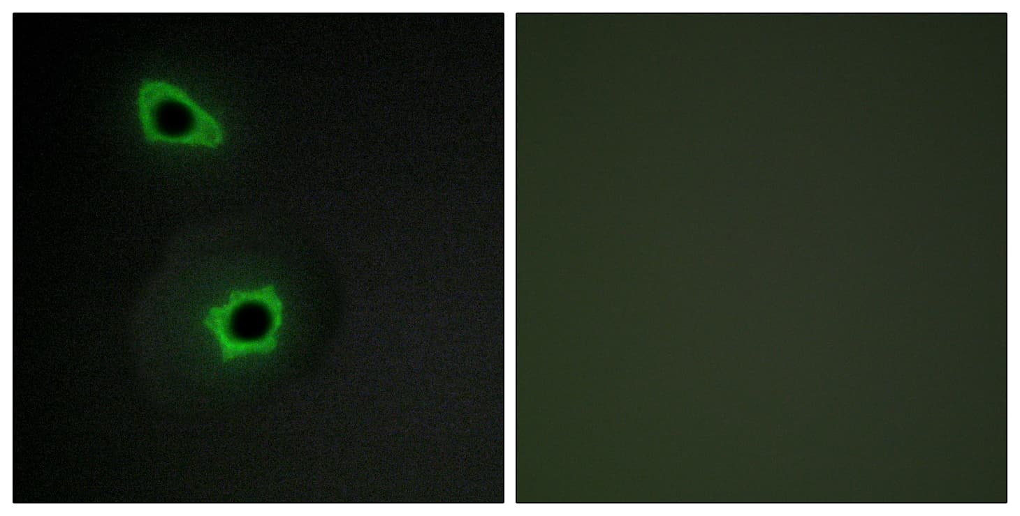 IHC-plus™ COL7A1 / Collagen VII Antibody (aa1841-1890)