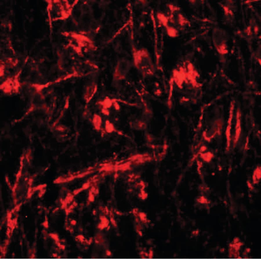 IHC-plus™ Polyclonal Rabbit anti-Human ORMDL1 Antibody (IHC, IF, WB)