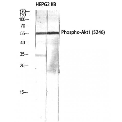 Polyclonal Rabbit anti-Human AKT1 Antibody (180-260 aa, IHC, IF, WB)
