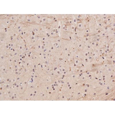 Polyclonal Rabbit anti-Human MAPT / Tau Antibody (phospho-Ser235, IHC, WB)