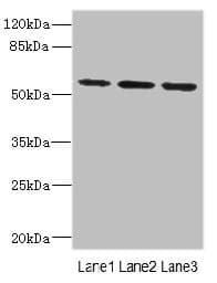IL17RB Antibody