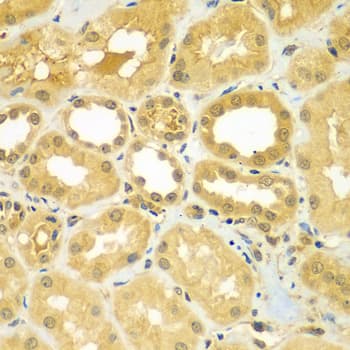 Polyclonal Rabbit anti-Human CALCOCO1 / CoCoa Antibody (IHC, IF, WB)