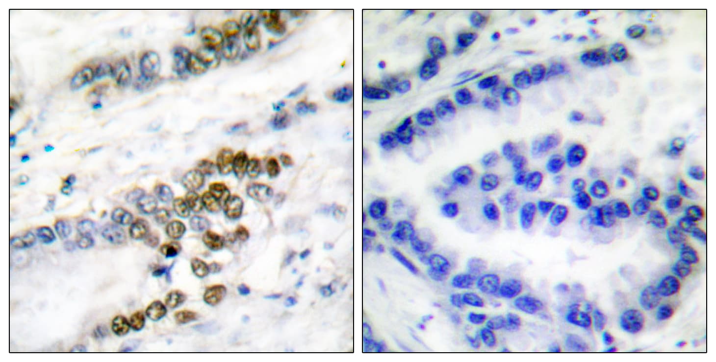 ERCC1 Antibody (aa141-190)