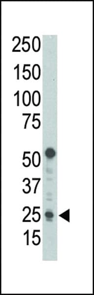 BBC3 / PUMA Antibody (aa119-154)