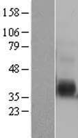 IL12B / IL12 p40 Protein (Over-Expression Lysate Myc-DDK (Flag))