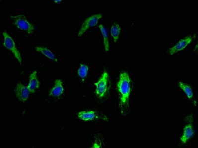 Polyclonal Rabbit anti-Human TMEM68 Antibody