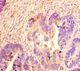 SCG2 / Secretogranin II Antibody