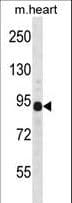 Polyclonal Rabbit anti-Human DTNA / Dystrobrevin Alpha Antibody (aa692-721, IHC, IF, WB)