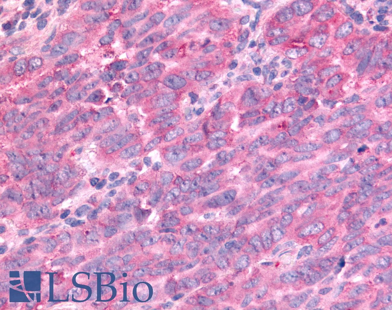 PathPlus™ PTPRE / PTP Epsilon Antibody (Cytoplasmic Domain)