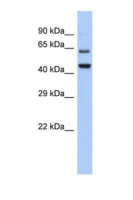 TMTC2 Antibody (aa564-613)