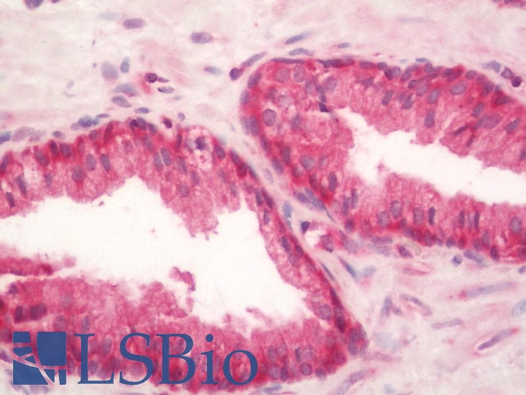 IHC-plus™ RPL3 / Ribosomal Protein L3 Antibody