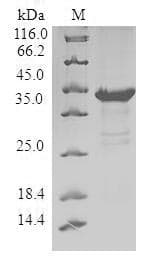 Human PHLDA2 / TSSC3 Protein (Recombinant GST, N-terminus)
