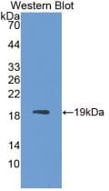 IL1RN Antibody