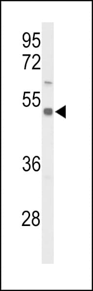 SLC39A8 / ZIP8 Antibody (aa218-246)