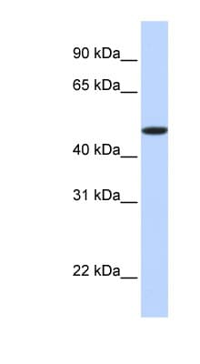 EPOR / EPO Receptor Antibody (N-Terminus)