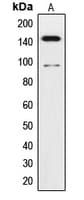 Polyclonal Rabbit anti-Human NTRK3 / TRKC Antibody (Internal, WB)