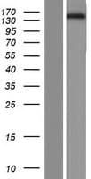 DUSP27 Protein (Over-Expression Lysate Myc-DDK (Flag))