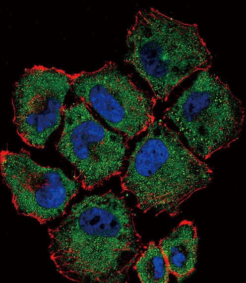 IHC-plus™ SLC36A1 Antibody (aa1-30)