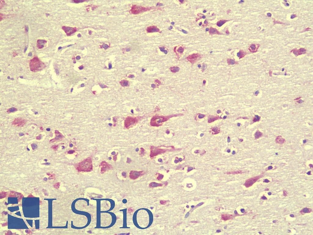 IHC-plus™ C1orf187 / DRAXIN Antibody