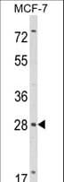 Polyclonal Rabbit anti-Human RASL11B Antibody (aa37-66, WB)