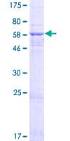 Human HSDL1 Protein (Recombinant GST)