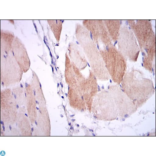 IL-1B / IL-1 Beta Antibody