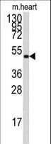 PRKAG1 / AMPK Gamma 1 Antibody (aa265-295)