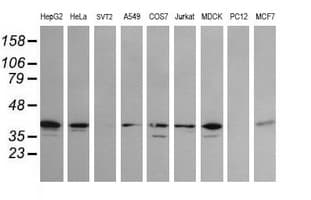 MAP2K3 / MEK3 / MKK3 Antibody (clone OTI2G8)